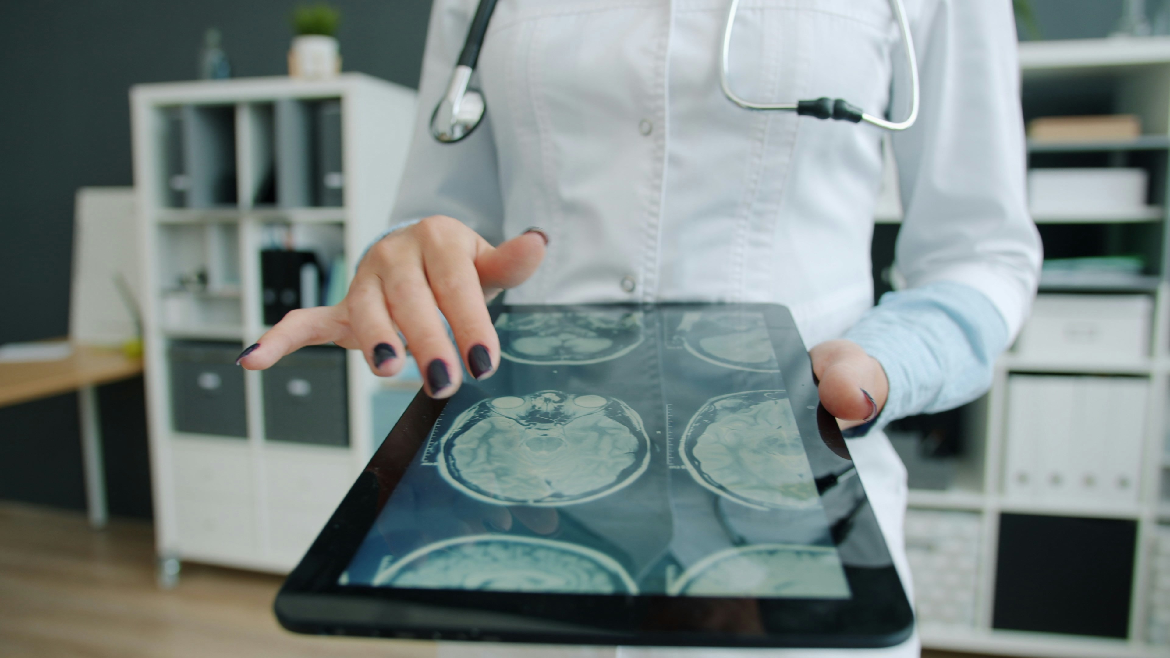 How to Force a Prior Authorization Appeal When an AI Bot Denied Your MRI?